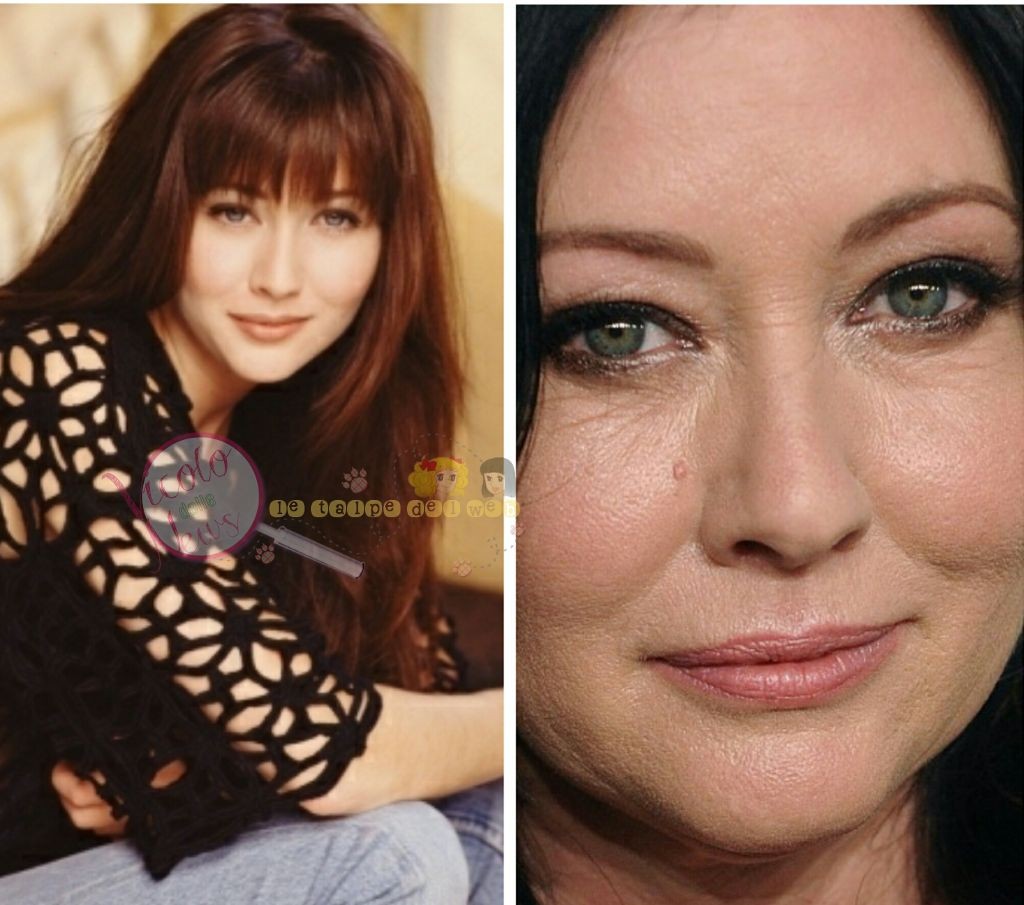 Shannen Doherty ieri e oggi